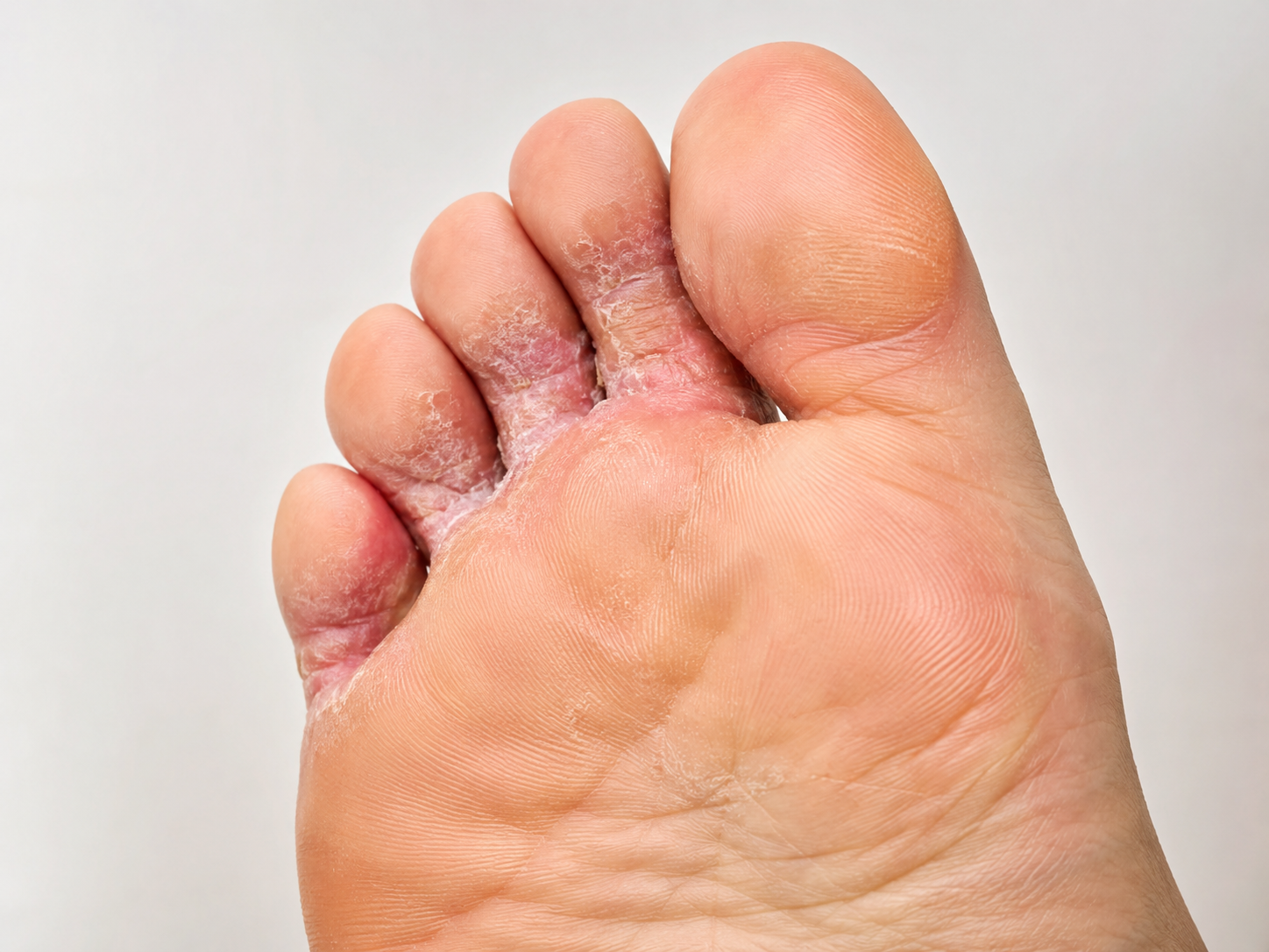EFSiRA DERMA PLUS